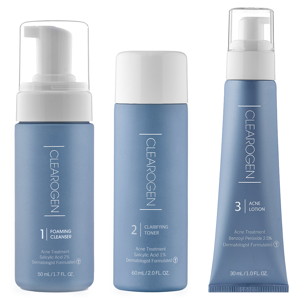 30-Day Ultimate Acne Clearing 3 Step Treatment with 2.5% Benzoyl Peroxide