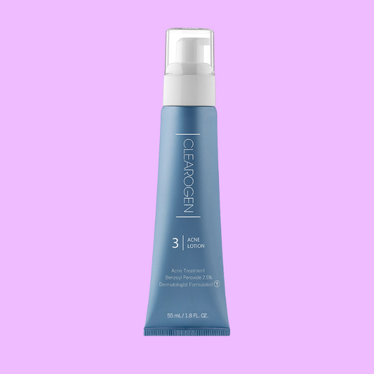 60-Day Ultimate Acne Clearing Lotion with 2.5 % Benzoyl Peroxide