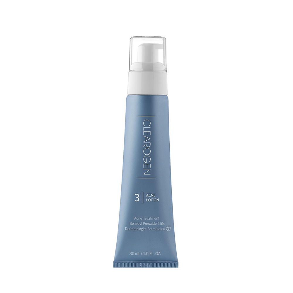 30-Day Ultimate Acne Clearing Lotion with 2.5 % Benzoyl Peroxide