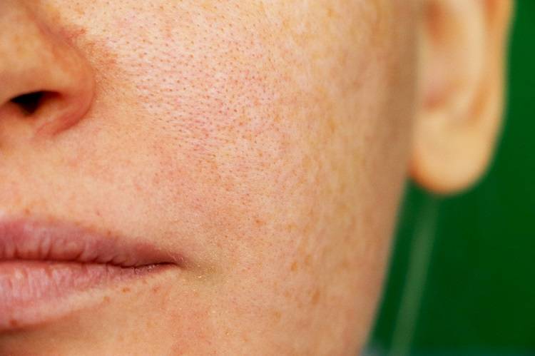 PSA: Stop Size Shaming Your Pores