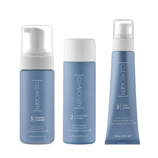 60-Day Miracle Acne Kit