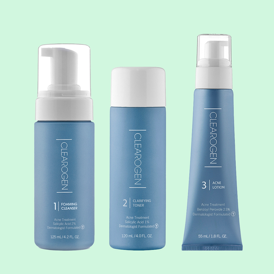60-Day Ultimate Acne Clearing 3 Step Treatment with 2.5% Benzoyl Peroxide