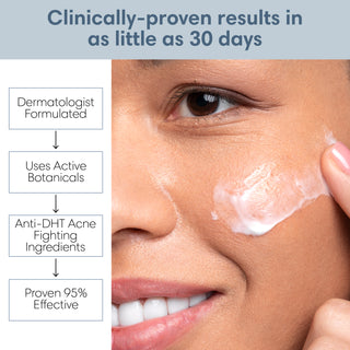 30 Day Acne Foaming Cleanser