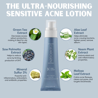30 Day Sensitive Skin Acne Lotion